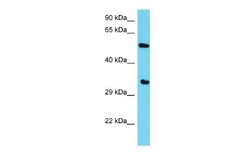 ARMH1 Rabbit anti-Human, Polyclonal, Novus Biologicals 0.1ml; Unconjugated:Antibodies,